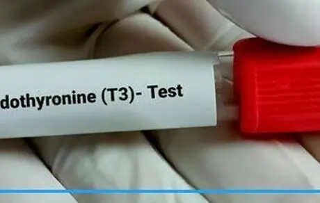 تشخیص کم کاری یا پرکاری تیروئید با آزمایش T3