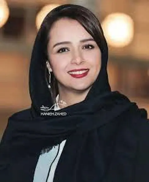 خالکوبی جنجالی ترانه علیدوستی  + عکس و بیوگرافی