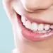 علت زردی دندان چیست ؟ 