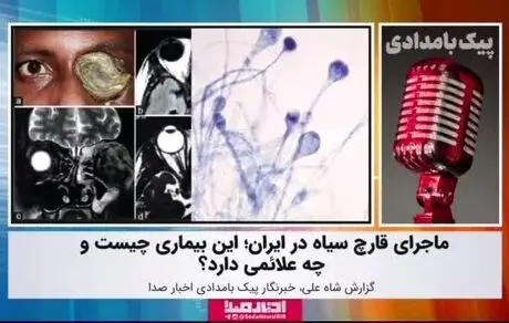 بهبود یافته‌های کرونایی به قارچ سیاه مبتلا می‌شوند؟ 