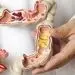 آی بی اس روده از نشانه تا درمان های ساده