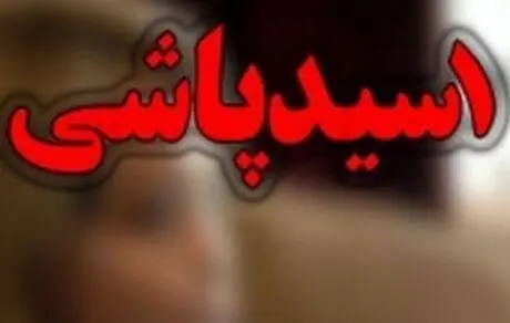 ​اسیدپاشی در خیابان دامپزشکی تهران، امروز/ متهم دستگیر شده است