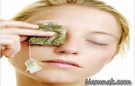 درمان قطعی پف زیر چشم با چای