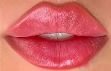 خطرات پنهان در لب‌های برجسته: عواقب ناگوار تزریق ژل لب در آرایشگاه‌ها