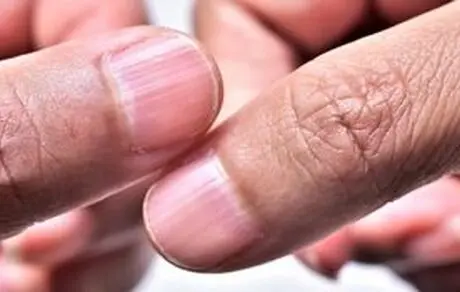 چند باور غلط پزشکی، اما شایع در زندگی روزمره