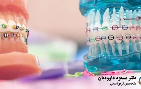 
هر آنچه می بایست در رابطه با ارتودنسی بدانید
