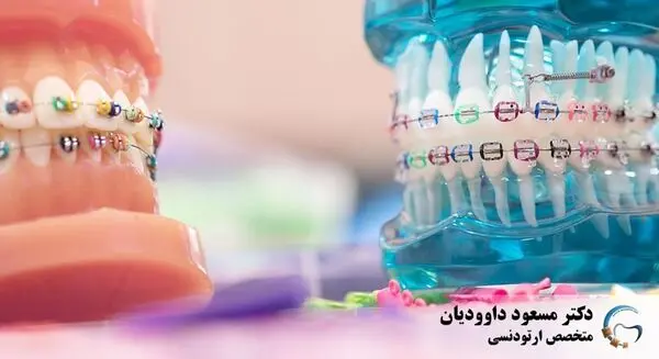 
هر آنچه می بایست در رابطه با ارتودنسی بدانید
