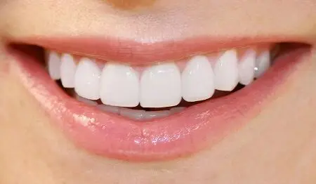 طرح لبخند