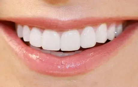 طرح لبخند