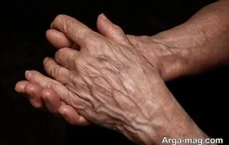 علت چروک و پیر شدن دست و روش های جلوگیری از آن