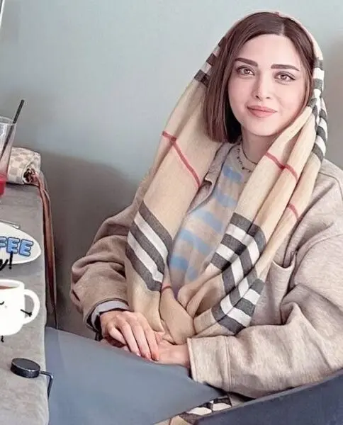 واکنش کاربران ایرانی شبکه‌های اجتماعی به جراحی زیبایی بازیگر معروف: زیباتر شده است! 