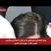 معرفی خدمات پوست و زیبایی در کلینیک هلیا