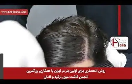 معرفی خدمات پوست و زیبایی در کلینیک هلیا