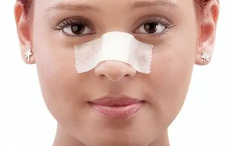 فقط سه گروه پزشکی مجاز به جراحی بینی هستند