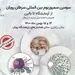 سرطان در ایران رو به رشد است
