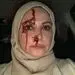 صورت زخمی و پُر از خون خانم بازیگر + عکس 