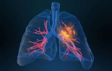 بهترین راهکار مقابله با کرونا