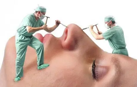 بهترین سن برای عمل زیبایی بینی