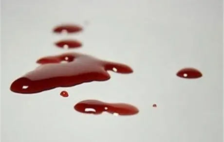  "دعوا" ۷۰۰۰۰ زن را راهی پزشکی قانونی کرد